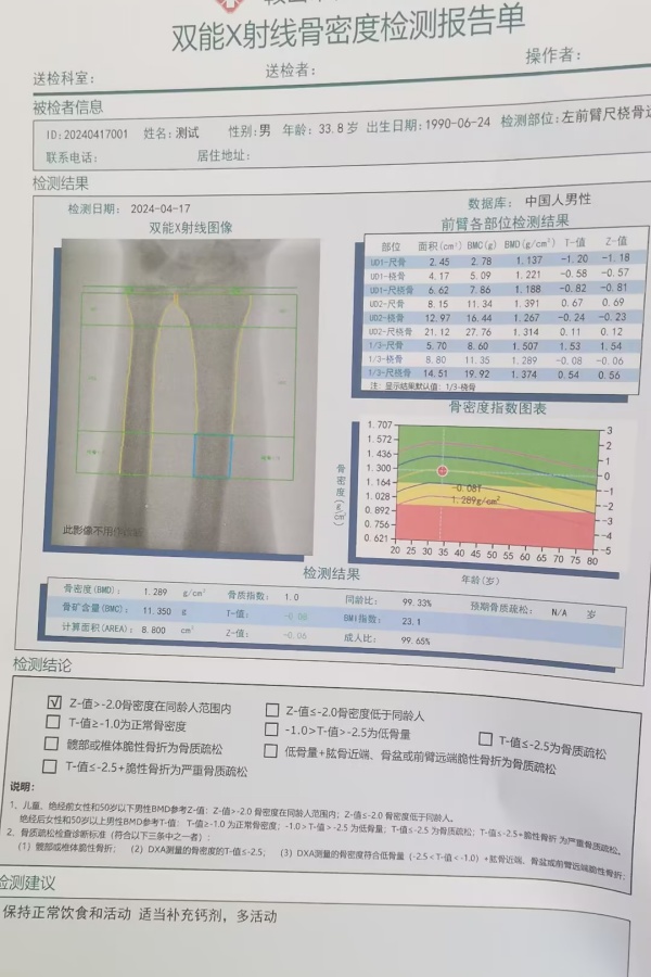 雙能X射線骨密度儀：準確測量骨密度，助力骨質疏松防治，守護骨骼健康